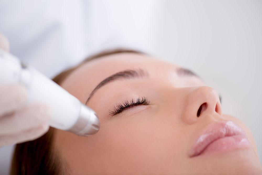193547 fotona 4d tratamento para rejuvenescimento da face
