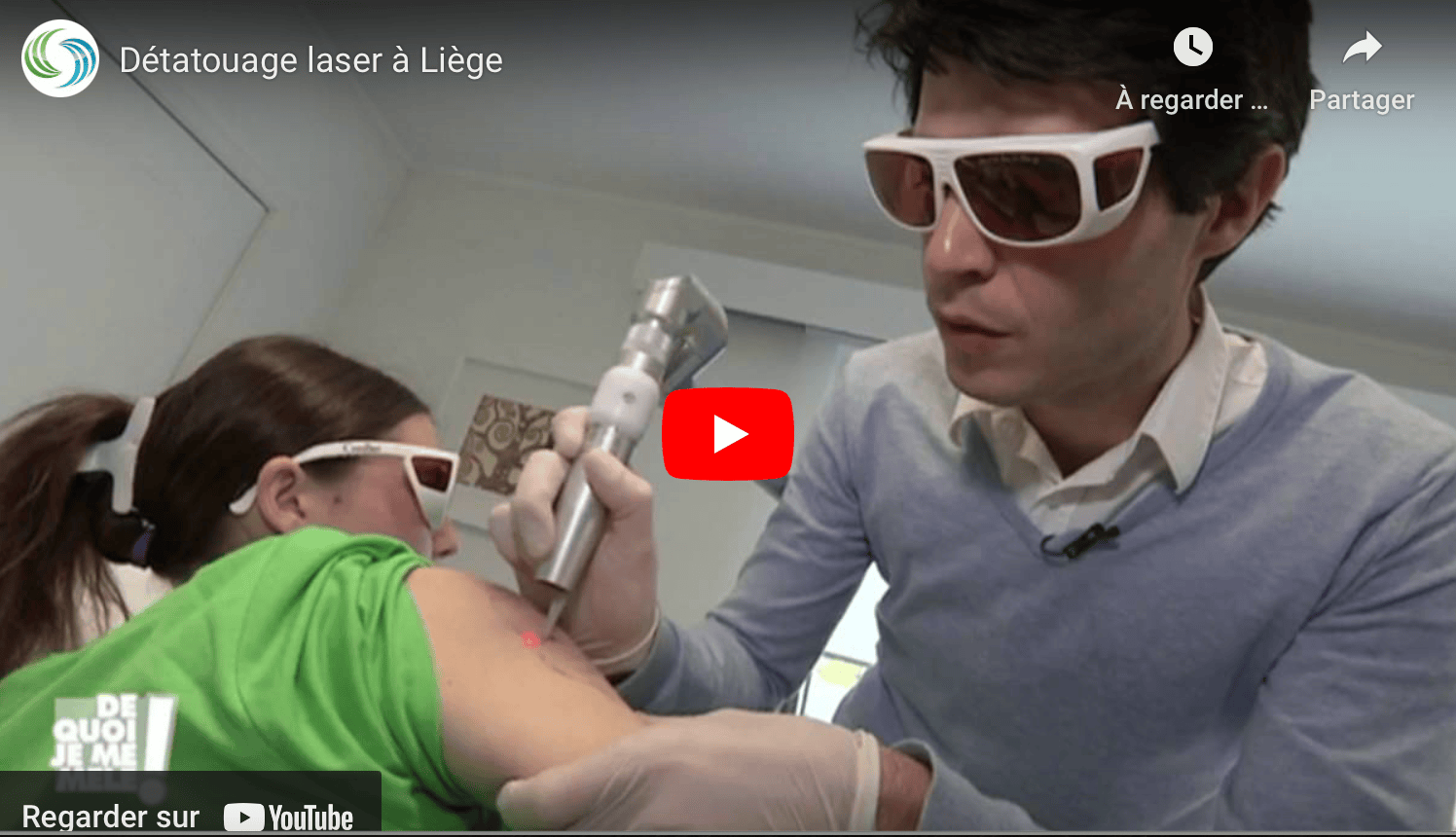 tarif detatouage laser liege